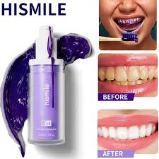 HiSmile V34 Teeth Whitener (RS-1299)